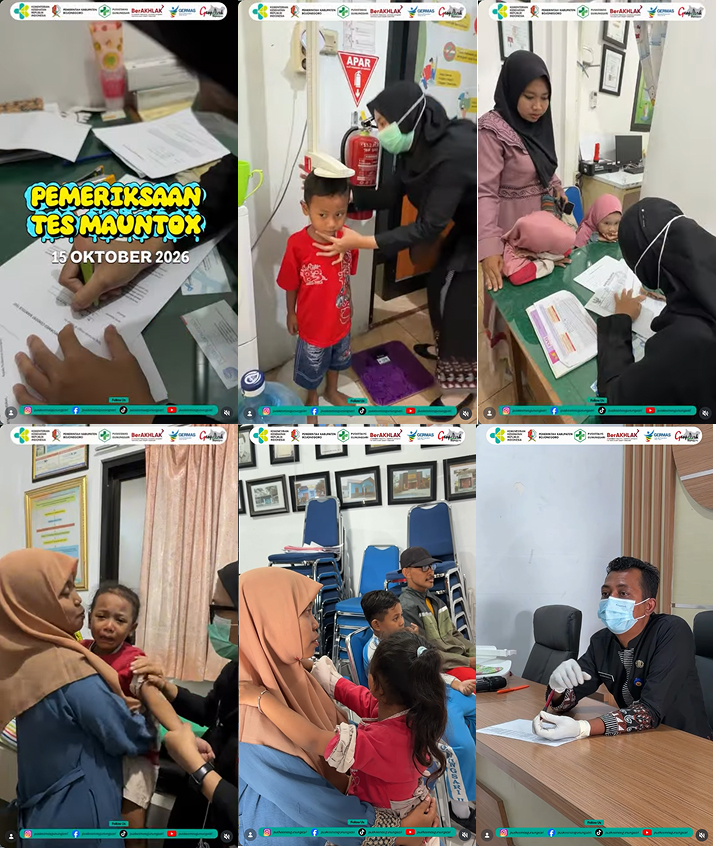 Pemeriksaan Tes Mantoux (Uji Tuberkulin) di Puskesmas Gunungsari